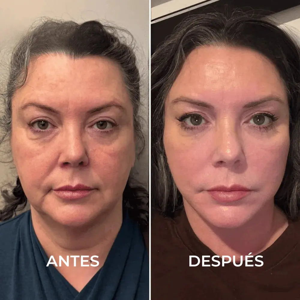 SoraSculpt – Cepillo facial